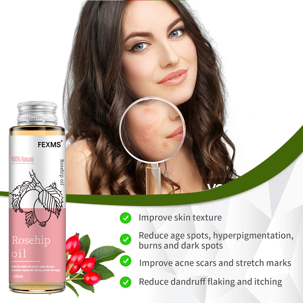 Rosehip Seed Oil, 100% Pure Or - Cold Pressed Rose Hip のレビューと価格