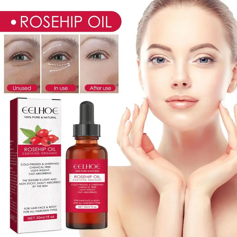 30ml Organic Rosehip Seed Oil  - Cold Pressed Rose Hip のレビューと価格