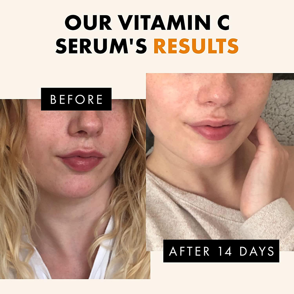 Super 120ml Vitamin C Serum An - Exosome Serum Ampoule のレビューと価格